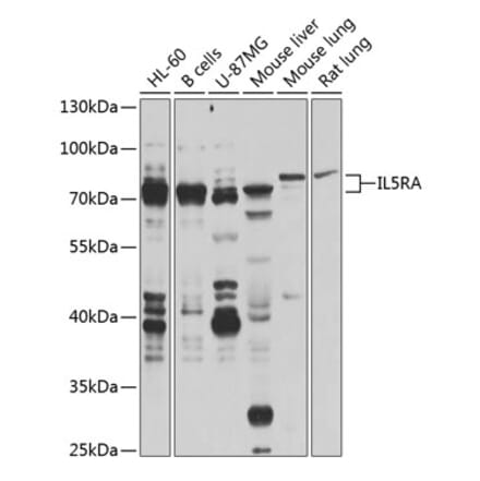 Western Blot - Anti-IL-5RA Antibody (A16228) - Antibodies.com