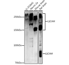 Western Blot - Anti-L1CAM Antibody (A16229) - Antibodies.com