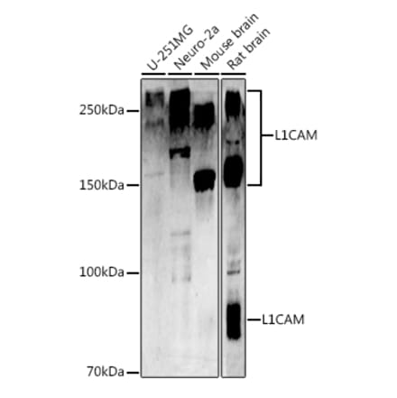 Western Blot - Anti-L1CAM Antibody (A16229) - Antibodies.com