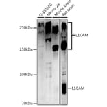 Western Blot - Anti-L1CAM Antibody (A16229) - Antibodies.com