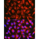 Immunofluorescence - Anti-L1CAM Antibody (A16229) - Antibodies.com