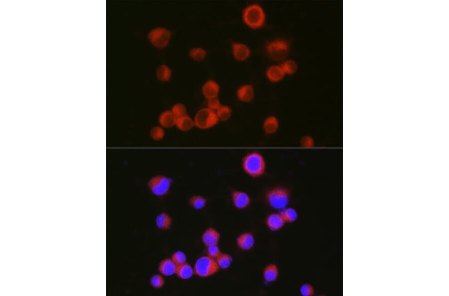 Immunofluorescence - Anti-L1CAM Antibody (A16229) - Antibodies.com
