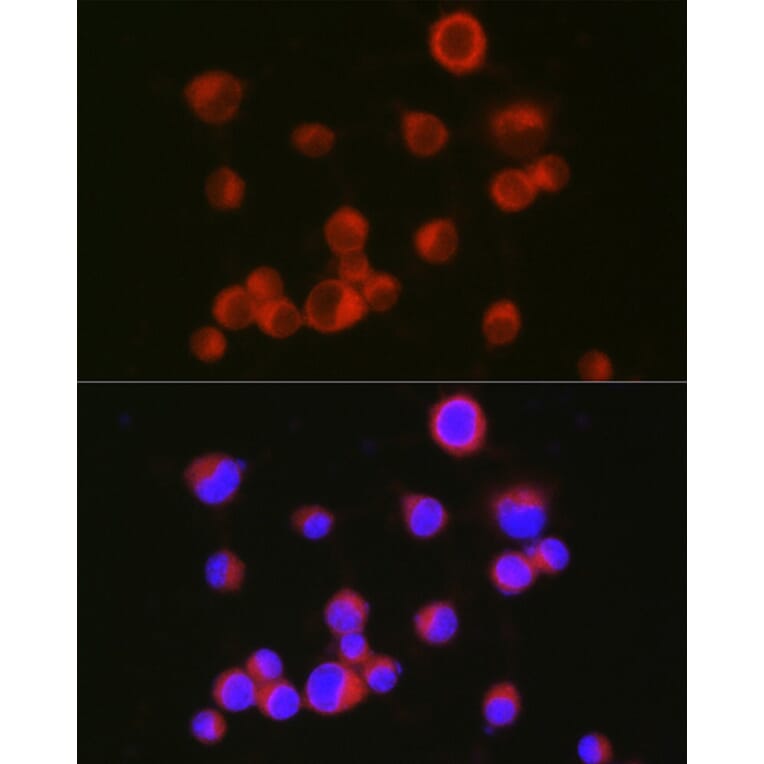 Immunofluorescence - Anti-L1CAM Antibody (A16229) - Antibodies.com