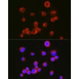Immunofluorescence - Anti-L1CAM Antibody (A16229) - Antibodies.com