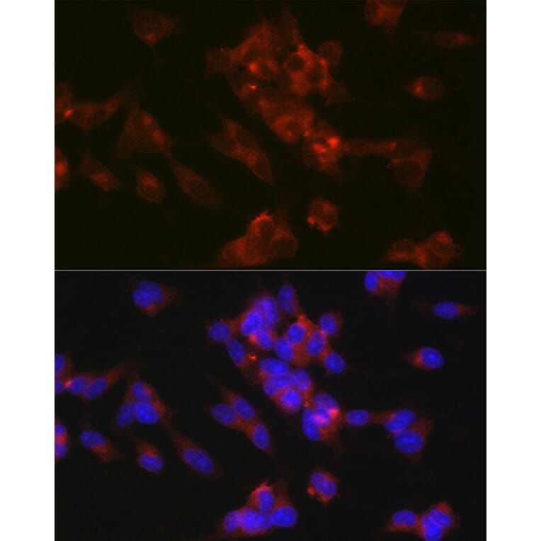 Immunofluorescence - Anti-L1CAM Antibody (A16229) - Antibodies.com