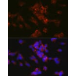 Immunofluorescence - Anti-L1CAM Antibody (A16229) - Antibodies.com