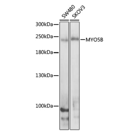 Western Blot - Anti-MYO5B Antibody (A16230) - Antibodies.com