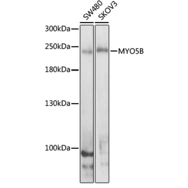 Western Blot - Anti-MYO5B Antibody (A16230) - Antibodies.com