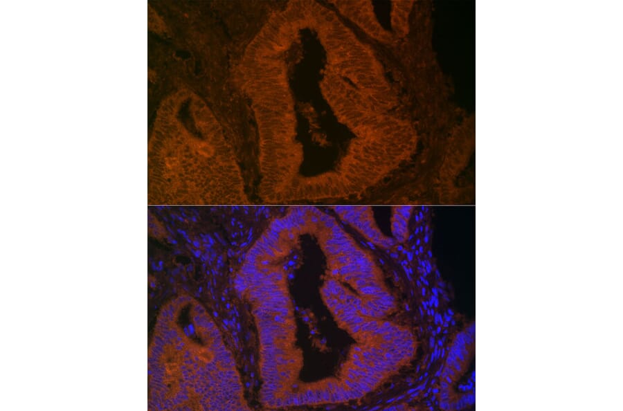 Immunofluorescence - Anti-MYO5B Antibody (A16230) - Antibodies.com