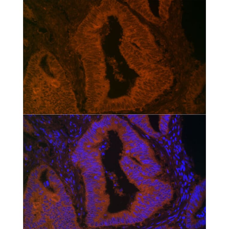 Immunofluorescence - Anti-MYO5B Antibody (A16230) - Antibodies.com