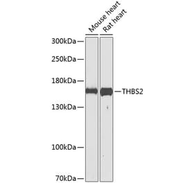 Western Blot - Anti-Thrombospondin 2 Antibody (A16231) - Antibodies.com