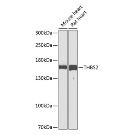 Western Blot - Anti-Thrombospondin 2 Antibody (A16231) - Antibodies.com