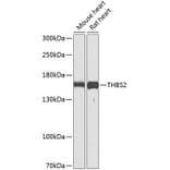 Western Blot - Anti-Thrombospondin 2 Antibody (A16231) - Antibodies.com