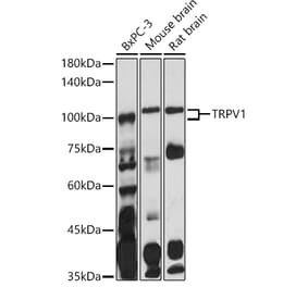Western Blot - Anti-TRPV1 Antibody (A16232) - Antibodies.com