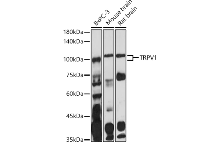 Western Blot - Anti-TRPV1 Antibody (A16232) - Antibodies.com
