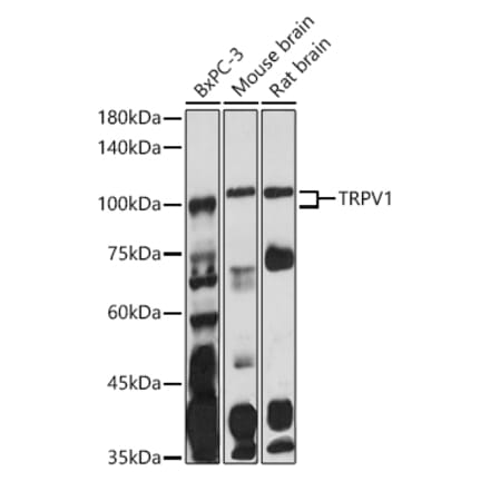 Western Blot - Anti-TRPV1 Antibody (A16232) - Antibodies.com