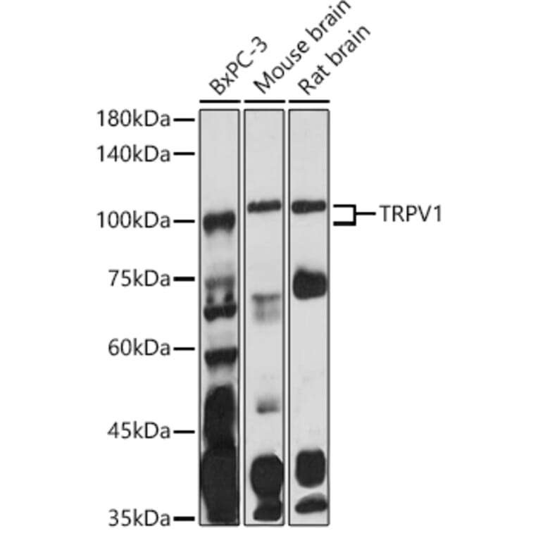 Western Blot - Anti-TRPV1 Antibody (A16232) - Antibodies.com