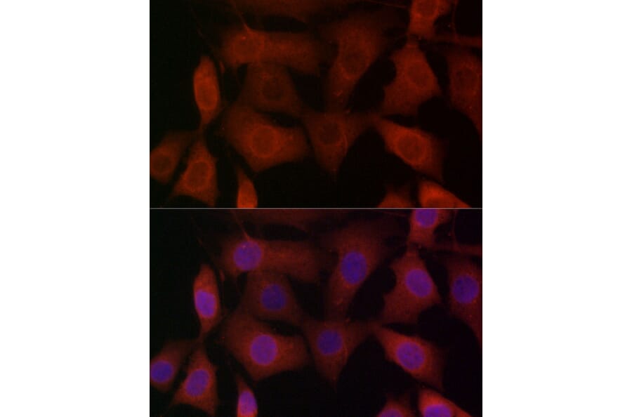 Immunofluorescence - Anti-TRPV1 Antibody (A16232) - Antibodies.com