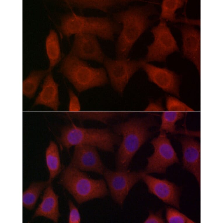Immunofluorescence - Anti-TRPV1 Antibody (A16232) - Antibodies.com