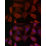 Immunofluorescence - Anti-TRPV1 Antibody (A16232) - Antibodies.com