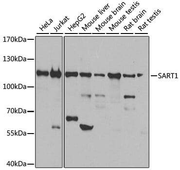 Western blot analysis of extracts of various cell lines, using Anti-SART1 Antibody (A8569) at 1:1,000 dilution.
Secondary antibody: Goat Anti-Rabbit IgG (H+L) (HRP) (AS014) at 1:10,000 dilution.
Lysates / proteins: 25µg per lane.
Blocking buffer: 3% non-fat dry milk in TBST.
Detection: ECL Basic Kit (RM00020).
Exposure time: 10s.