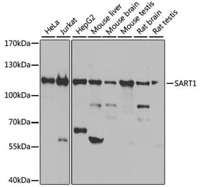 Western Blot - Anti-SART1 Antibody (A16233) - Antibodies.com