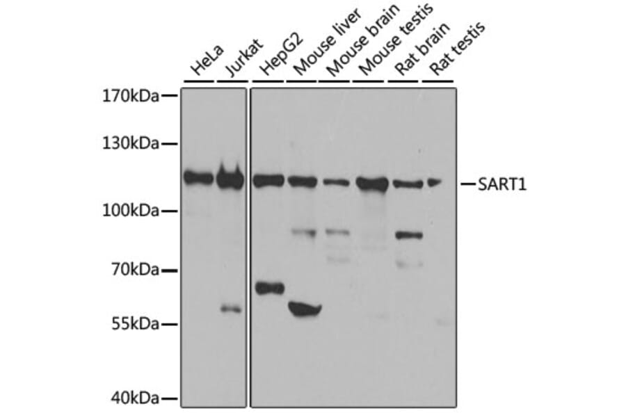 Western Blot - Anti-SART1 Antibody (A16233) - Antibodies.com
