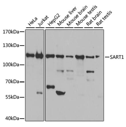 Western Blot - Anti-SART1 Antibody (A16233) - Antibodies.com