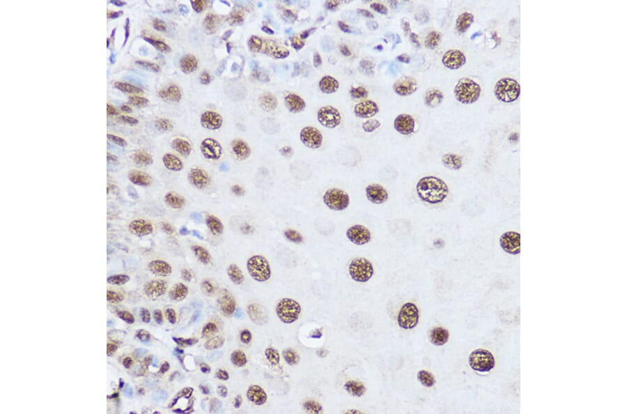 Immunohistochemistry - Anti-SART1 Antibody (A16233) - Antibodies.com
