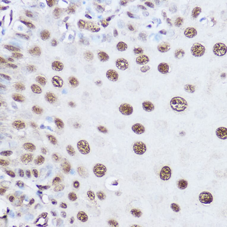 Immunohistochemistry - Anti-SART1 Antibody (A16233) - Antibodies.com