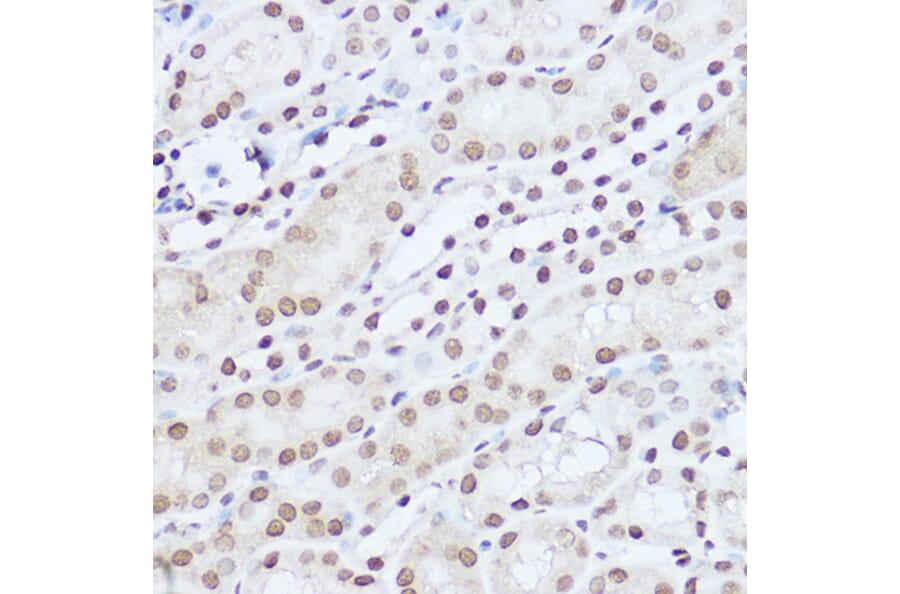 Immunohistochemistry - Anti-SART1 Antibody (A16233) - Antibodies.com