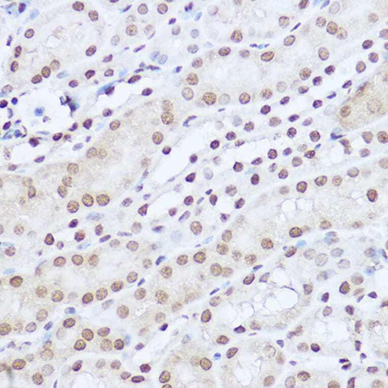 Immunohistochemistry - Anti-SART1 Antibody (A16233) - Antibodies.com