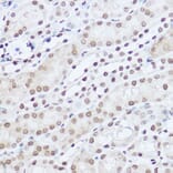 Immunohistochemistry - Anti-SART1 Antibody (A16233) - Antibodies.com