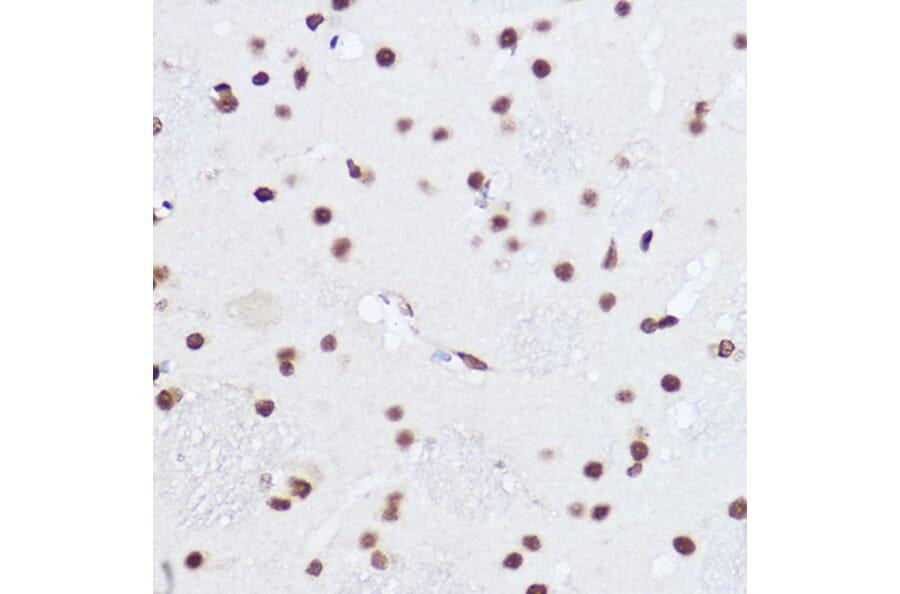 Immunohistochemistry - Anti-SART1 Antibody (A16233) - Antibodies.com