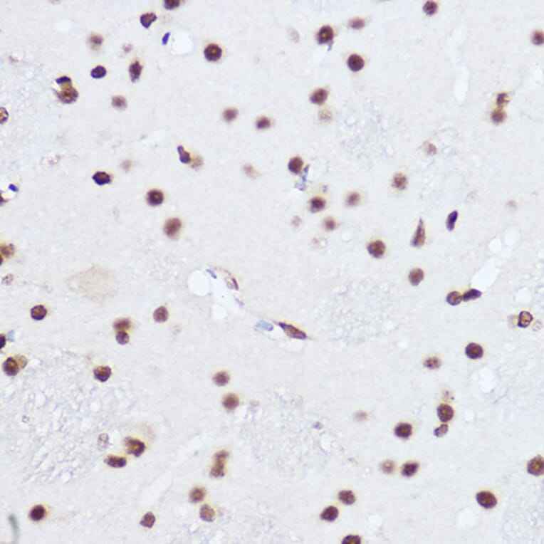 Immunohistochemistry - Anti-SART1 Antibody (A16233) - Antibodies.com