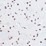 Immunohistochemistry - Anti-SART1 Antibody (A16233) - Antibodies.com