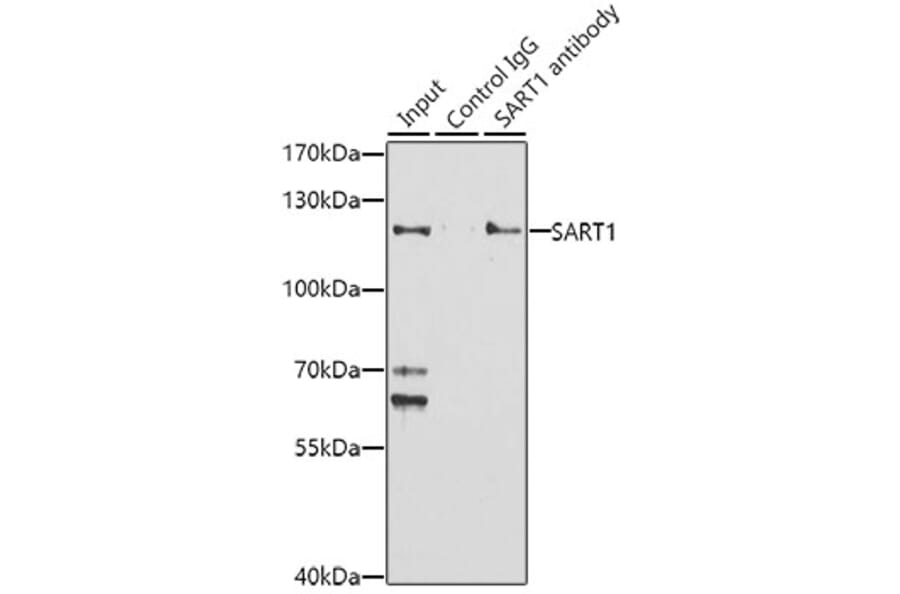 Western Blot - Anti-SART1 Antibody (A16233) - Antibodies.com