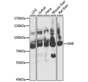 Western Blot - Anti-GNE Antibody (A16234) - Antibodies.com