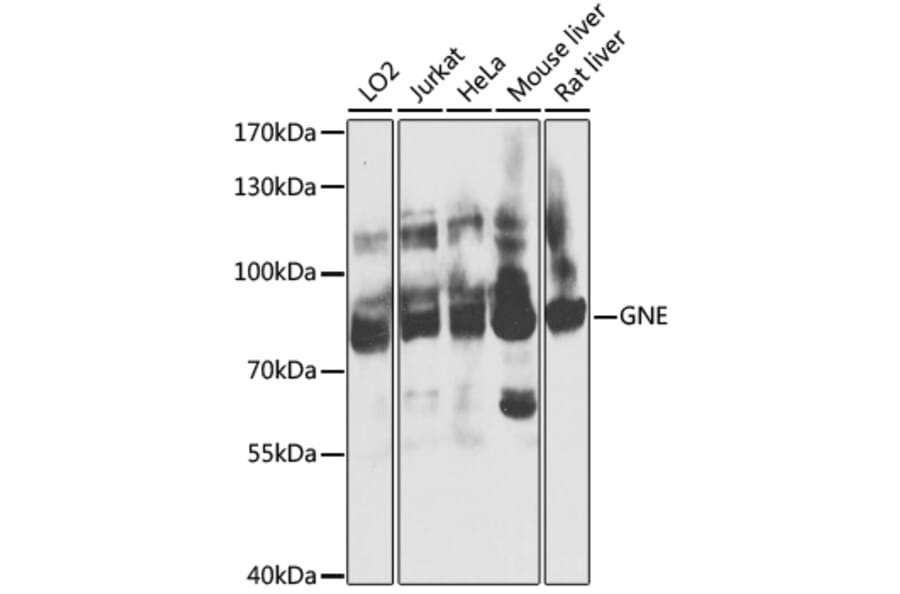 Western Blot - Anti-GNE Antibody (A16234) - Antibodies.com