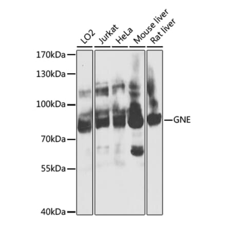 Western Blot - Anti-GNE Antibody (A16234) - Antibodies.com