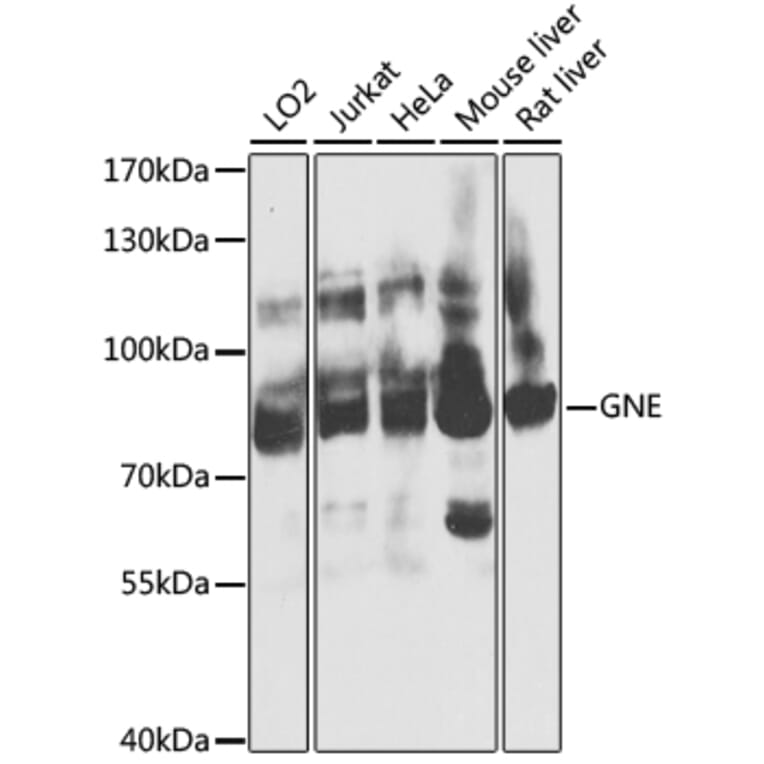 Western Blot - Anti-GNE Antibody (A16234) - Antibodies.com