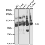 Western Blot - Anti-GNE Antibody (A16234) - Antibodies.com