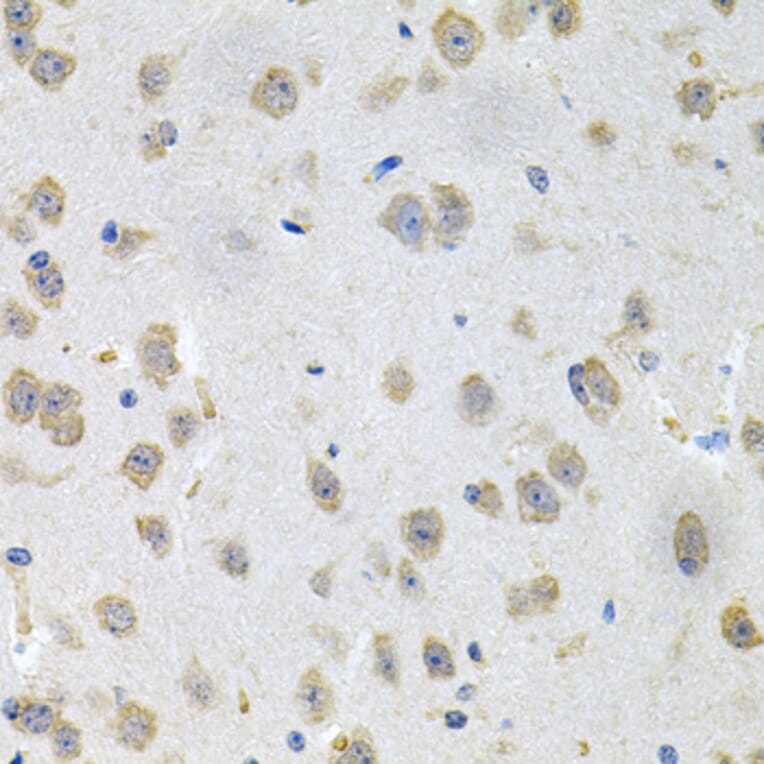 Immunohistochemistry - Anti-GNE Antibody (A16234) - Antibodies.com