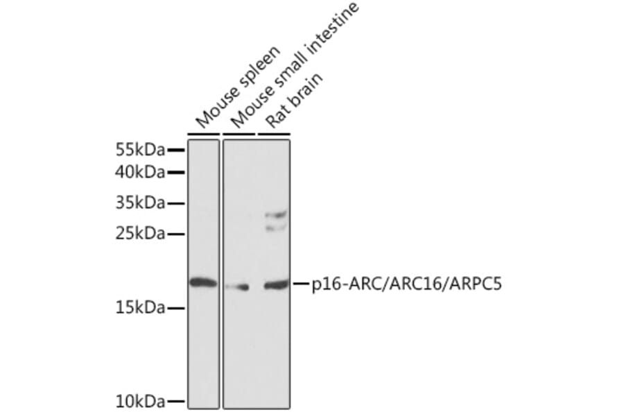 Western Blot - Anti-ARPC5/p16 ARC Antibody (A16235) - Antibodies.com