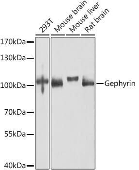Western blot analysis of extracts of various cell lines, using Anti-GPHN Antibody (A8572) at 1:1,000 dilution.
Secondary antibody: Goat Anti-Rabbit IgG (H+L) (HRP) (AS014) at 1:10,000 dilution.
Lysates / proteins: 25µg per lane.
Blocking buffer: 3% non-fat dry milk in TBST.
Detection: ECL Basic Kit (RM00020).
Exposure time: 30s.