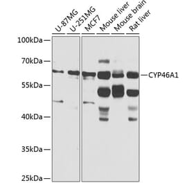 Western Blot - Anti-CYP46A1 Antibody (A16237) - Antibodies.com