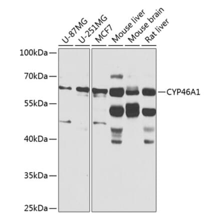 Western Blot - Anti-CYP46A1 Antibody (A16237) - Antibodies.com