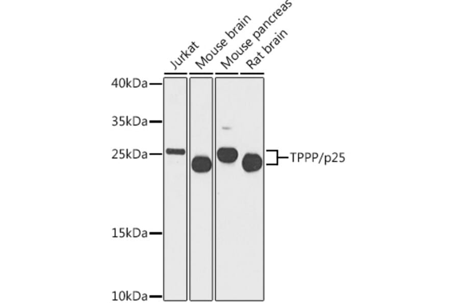 Western Blot - Anti-TPPP Antibody (A16238) - Antibodies.com