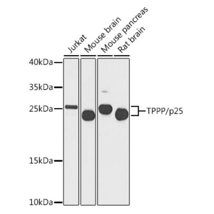 Western Blot - Anti-TPPP Antibody (A16238) - Antibodies.com