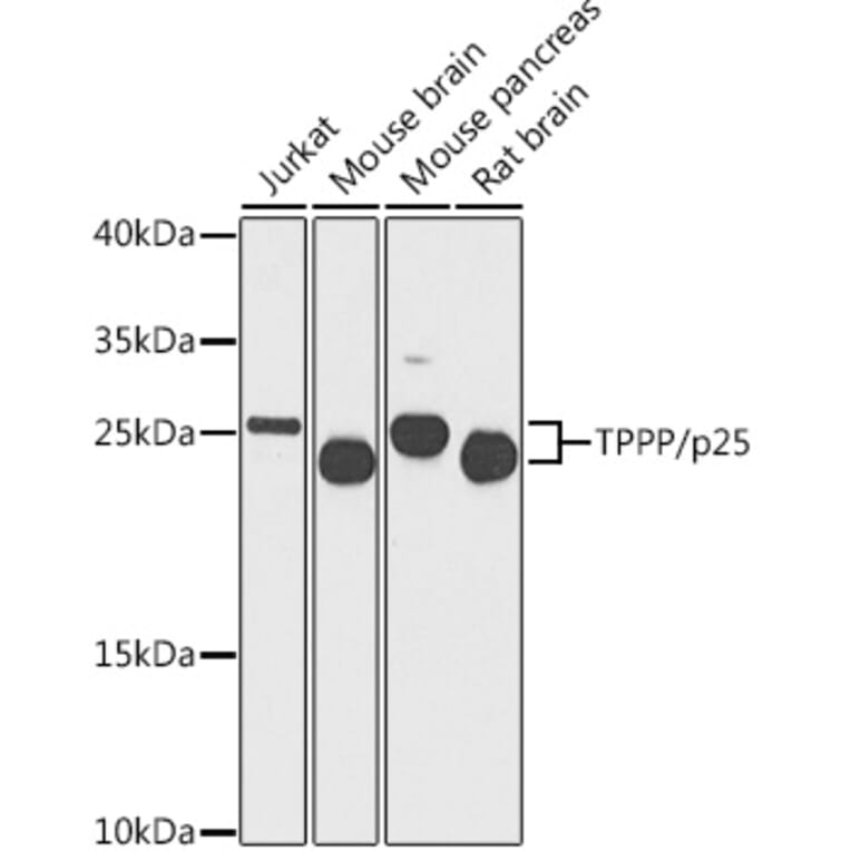 Western Blot - Anti-TPPP Antibody (A16238) - Antibodies.com